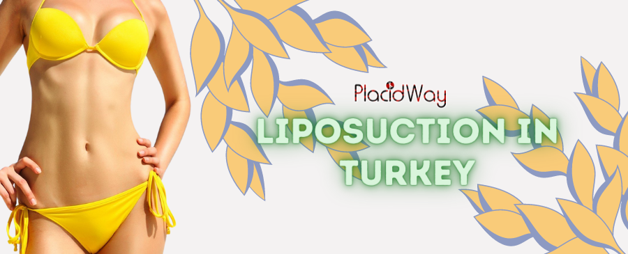 Liposucción asequible en Turquía: ahorre hasta un 75 %