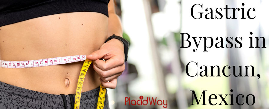 Bypass Gástrico Cancún, México