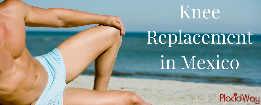 Reemplazo de rodilla en México