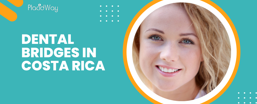 Puentes dentales en Costa Rica: su mejor opción para una nueva sonrisa