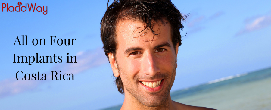 Implantes dentales All on 4 en Costa Rica