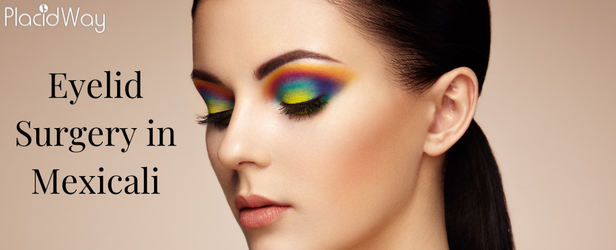 Cirugía de Párpados en Mexicali