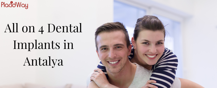 Implantes dentales All on 4 en Antalya