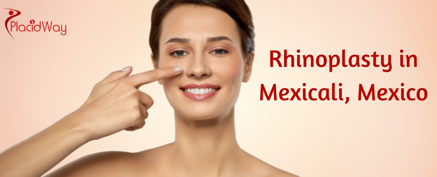 Rinoplastia en Mexicali, México