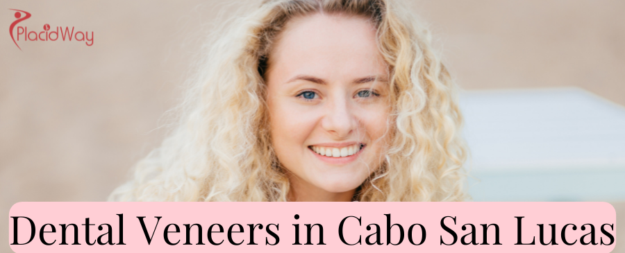 Carillas dentales en Cabo San Lucas