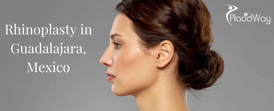 Rinoplastia en Guadalajara, México