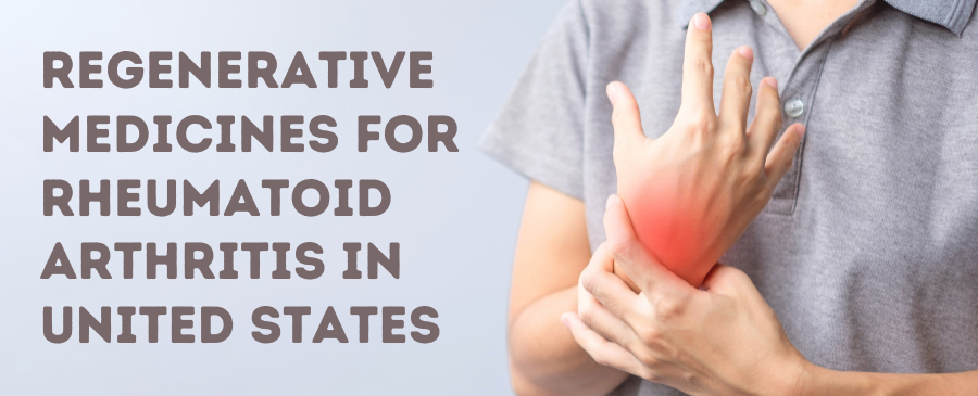 Medicina regenerativa para la artritis reumatoide en Estados Unidos