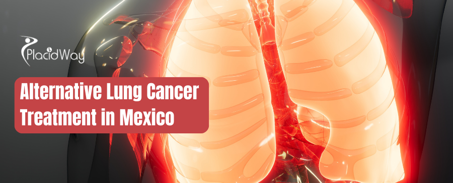 Tratamiento alternativo del cáncer de pulmón en México