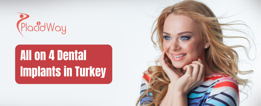 Implantes dentales All on 4 en Turquía