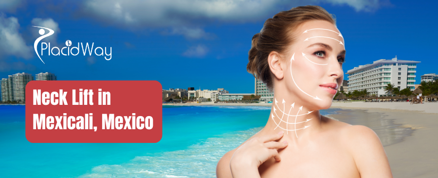 Lifting de cuello en Mexicali, México