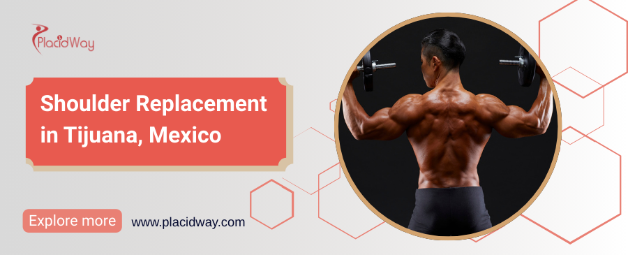 Reemplazo de hombro en Tijuana, México