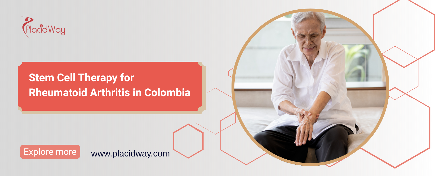 Terapia con células madre para la artritis reumatoide en Colombia
