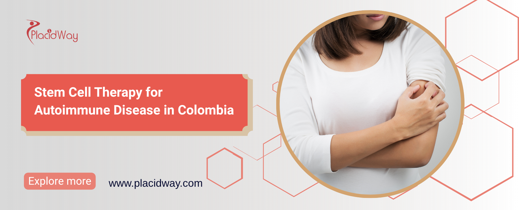 Terapia con células madre para enfermedades autoinmunes en Colombia