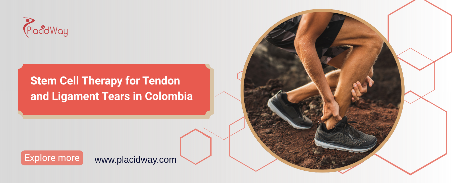 Terapia con células madre para desgarros de tendones y ligamentos en Colombia