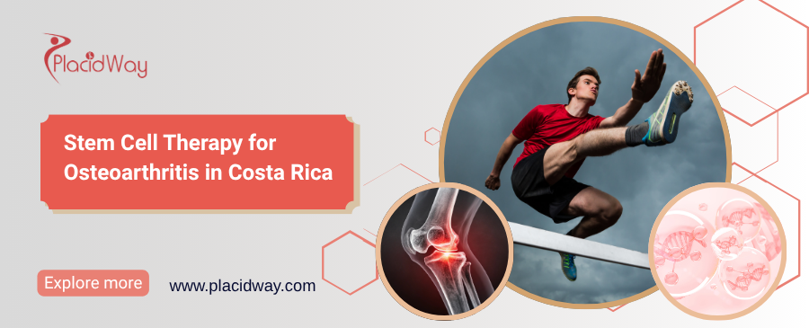 Terapia con células madre para la osteoartritis en Costa Rica