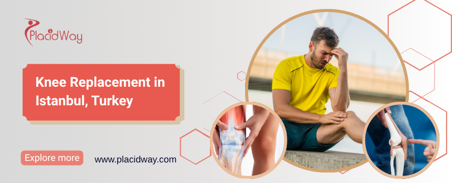 Reemplazo de rodilla en Estambul, Turquía