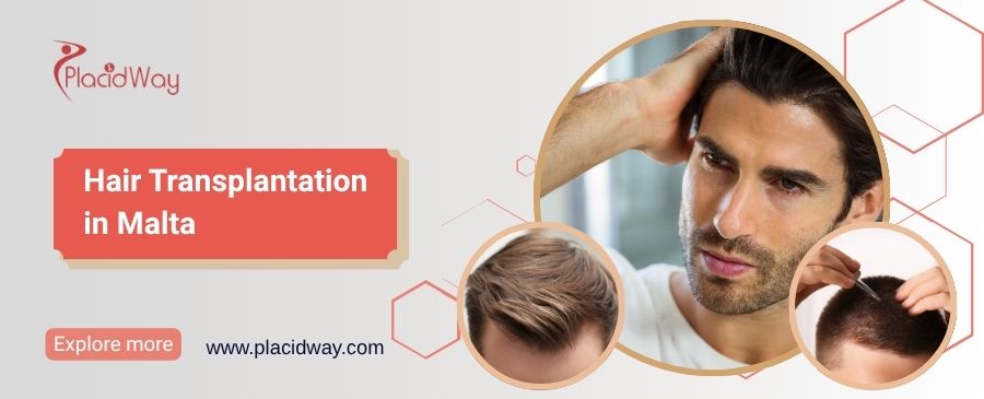 Trasplante de cabello en Malta