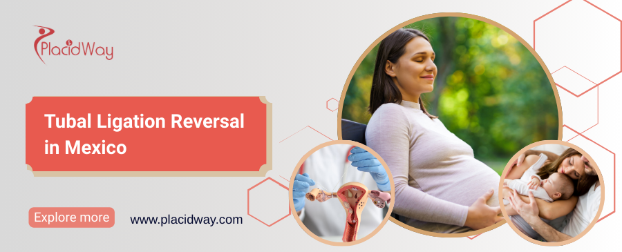 Reversión de la ligadura de trompas en México: método eficaz para dar a luz
