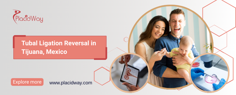 Reversión de ligadura de trompas en Tijuana, México