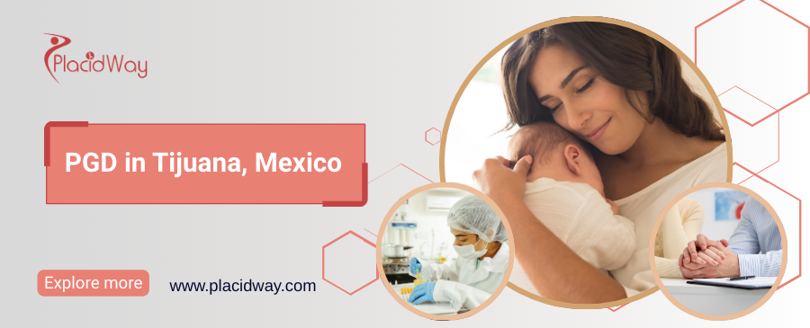 PGD en Tijuana, México