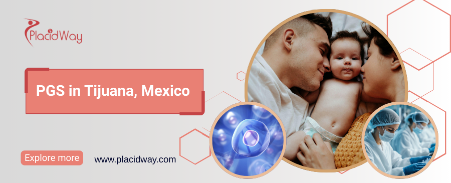 PGS en Tijuana, México