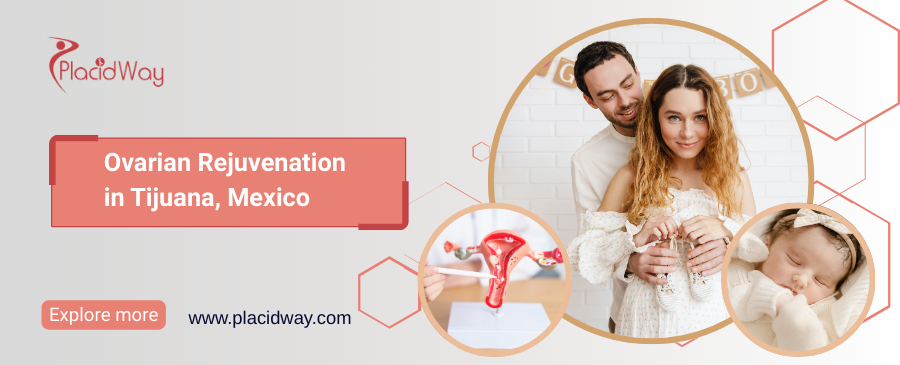 Rejuvenecimiento ovárico en Tijuana, México
