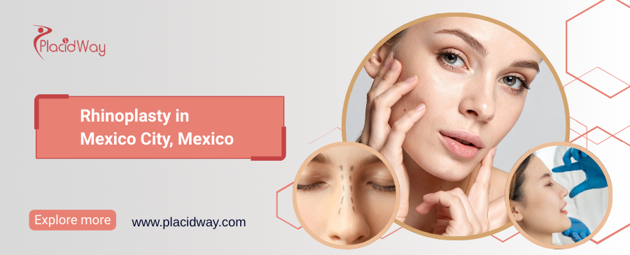Rinoplastia en la Ciudad de México, México