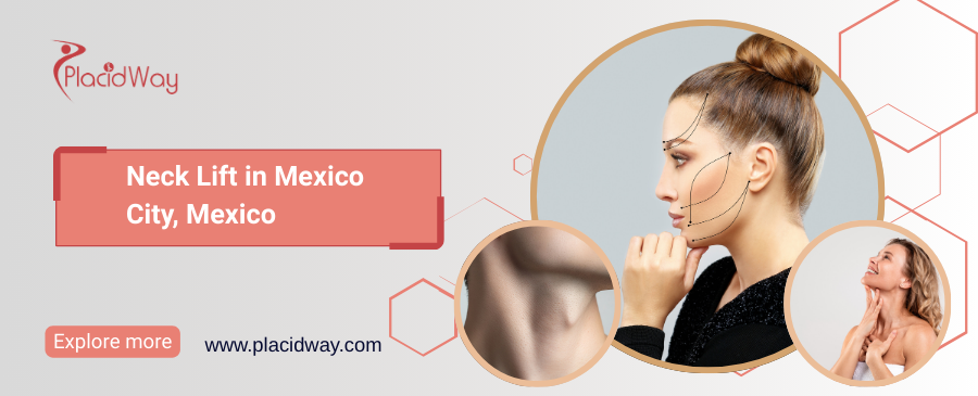 Lifting de cuello en la Ciudad de México, México