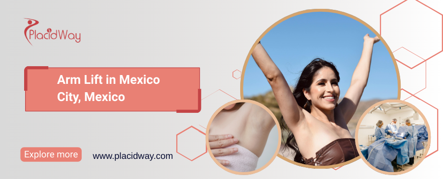 Lifting de brazos en la Ciudad de México, México