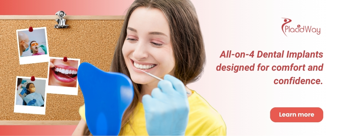 Implante dental All on 4 en Bogotá Colombia