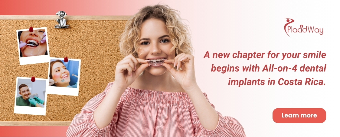Implantes dentales All on 4 en Costa Rica