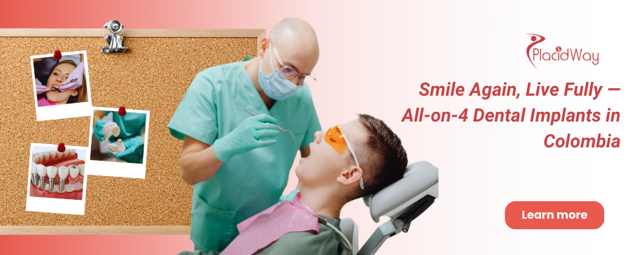 Implantes dentales All on 4 en Colombia