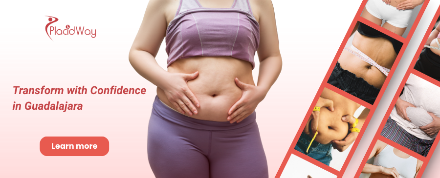 Abdominoplastia en Guadalajara México – ¡Recupera tu cuerpo de antes del embarazo!
