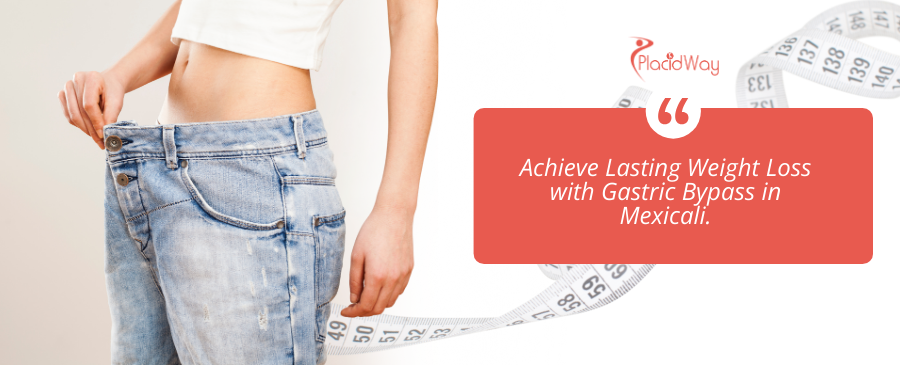 Bypass Gástrico en Mexicali, México