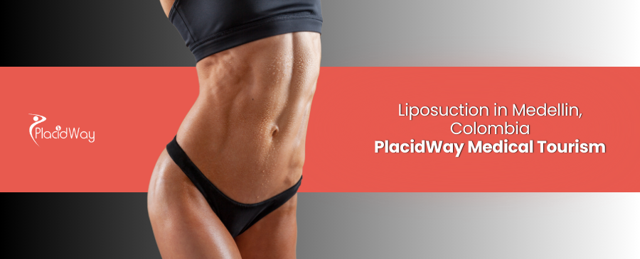 Liposucción en Medellín, Colombia