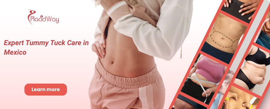 Abdominoplastia en Tijuana México – ¡Mejora la forma de tu cuerpo!