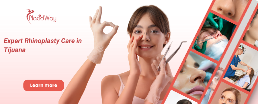 Rinoplastia en Tijuana