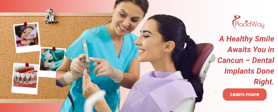 Implantes dentales en Cancún, México