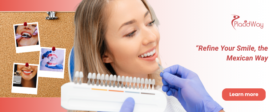 Carillas dentales en Puerto Vallarta México