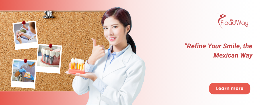 Implantes dentales All on 8 en Tijuana - Tratamiento dental asequible en México