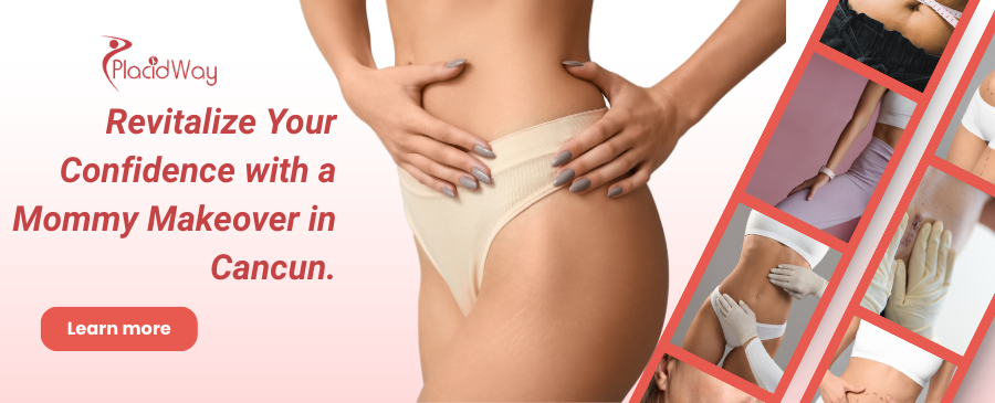 Mommy Makeover en Cancún, México