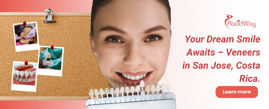 Carillas dentales en San José Costa Rica