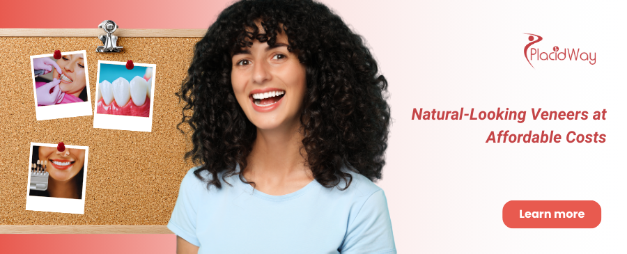 Carillas dentales en Tijuana, México