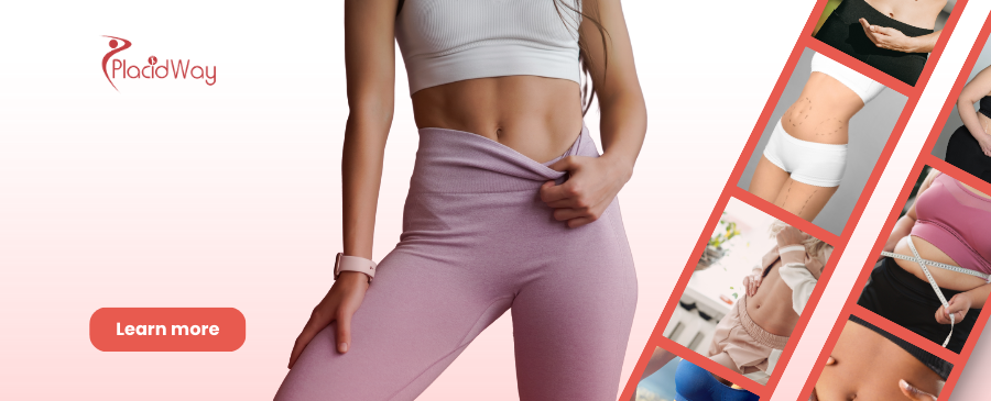 Abdominoplastia en la Ciudad de México