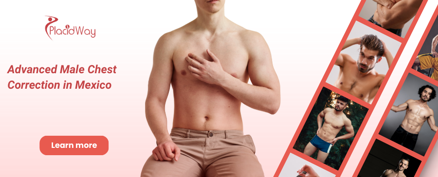 Ginecomastia Guadalajara, México