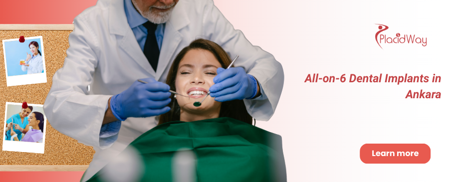 Implantes All-on-6 Ankara, Turquía