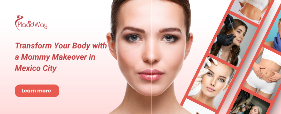 Mommy Makeover en la Ciudad de México, México