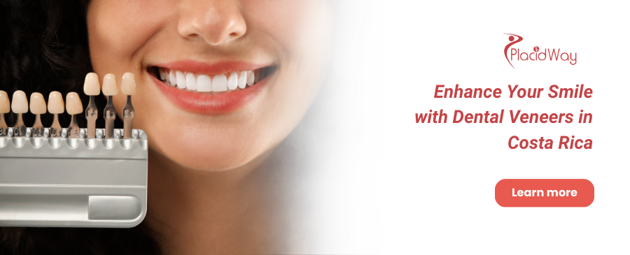 Carillas dentales en Costa Rica