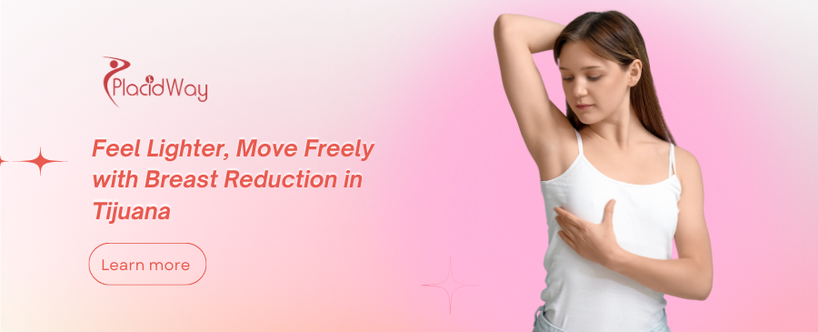 Reducción de Senos en Tijuana, México - Reduce el Tamaño de Tus Senos