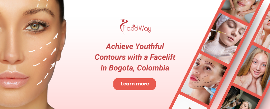 Lifting facial en Bogotá, Colombia